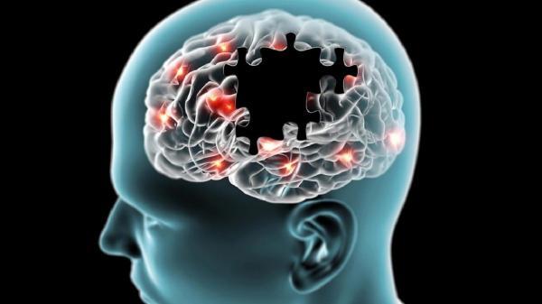 شناسایی و کشف دلیل پیشرفت آلزایمر در مغز